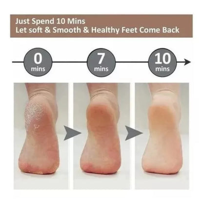 Professional Callus Remover-USB Rechargeable Electric Foot Sander